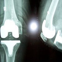 Arthroscopy Surgeon in Ahmedabad